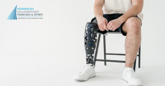man with an artificial leg